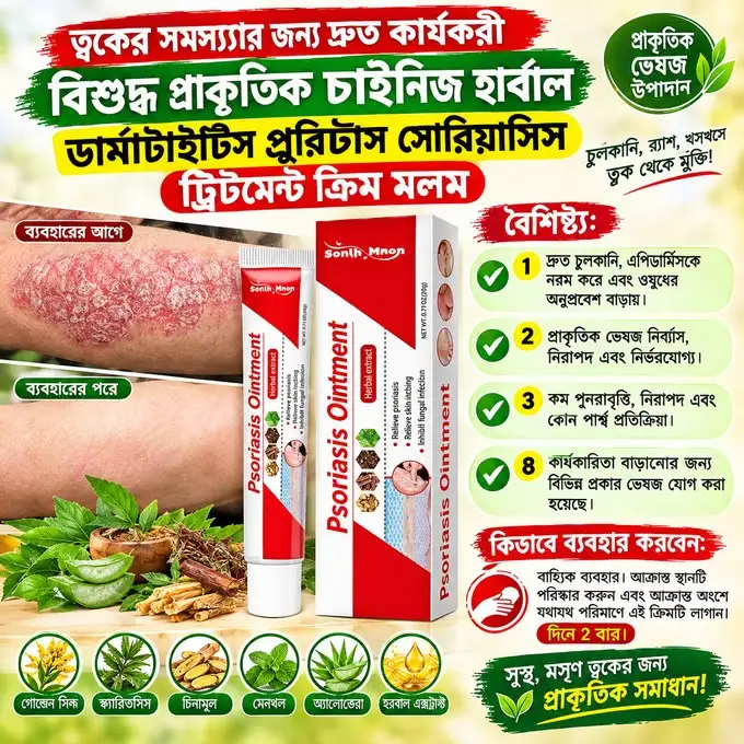 Psoriasis Ointment (চুলকানি ও ত্বকের সমস্যার জন্য অয়েন্টমেন্ট)